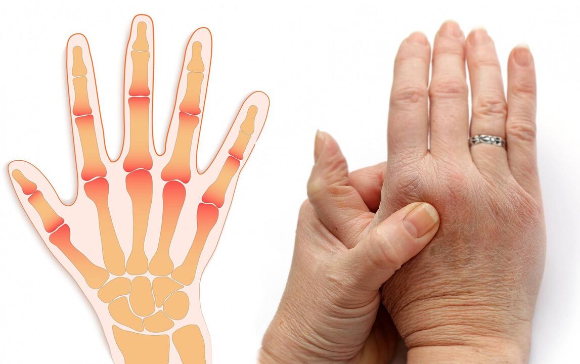 Ασθένειες των δακτύλων