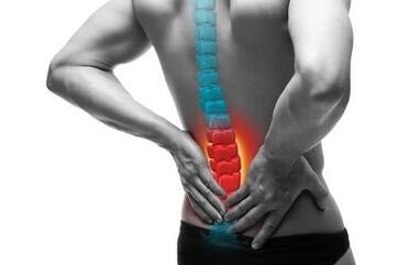 Η οστεοχόνδρωση είναι μια ασθένεια της σπονδυλικής στήλης